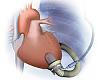 Heart Pump-j2k_illustration1-1-.jpg