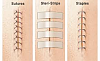 Alternative to glue?-steri-strips.png